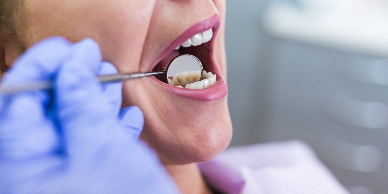 Wurzelbehandlung Besser als ihr Ruf? Team Dental